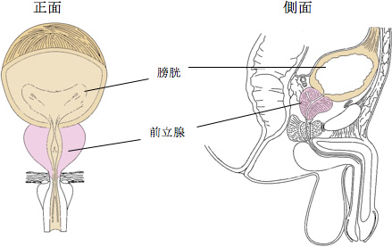 前立腺炎の東洋医学解説 /大阪の鍼灸治療家集団 一鍼堂
