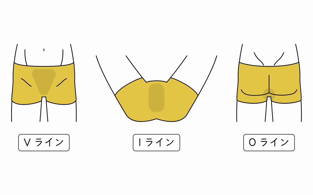 男性アンダーヘア（チン毛）の処理・調節方法とおすすめデザインを紹介 | メンズ脱毛百科事典 リンクスペディア