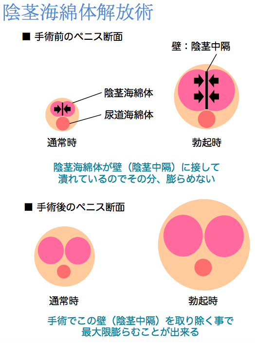 オナ禁はペニス増大に効果なし！メリットが多い、正しいオナニーを実施すべし｜あんしん通販コラム