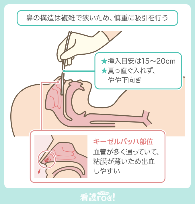 リンク挿入の基本：効果的に配置する方法 - SEOptimer