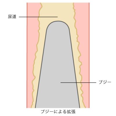 ドキュメンタリー【激レア】初の尿道プレイにマゾ泣き、中空プラグで空気が流入し前代未聞の前々（尿道）おならを豪快に発し羞恥する 淫乱OL 満子