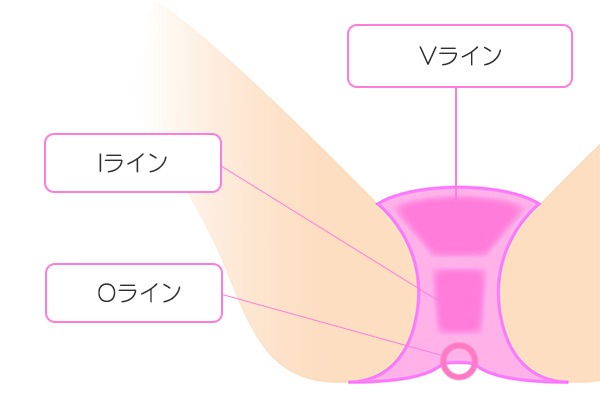 vioの自己処理方法！チクチクしない剃り方・やり方を徹底解説【画像付】 | ミツケル