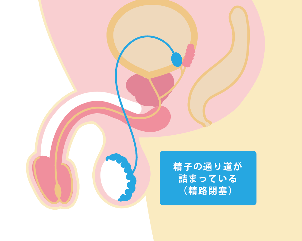 男性不妊症検査 | 扇町レディースクリニック