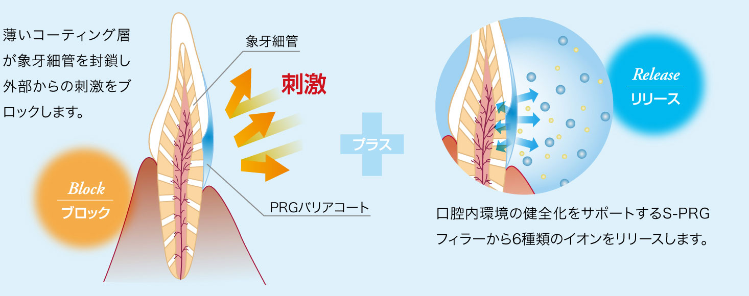 補綴臨床 別冊 前歯部ダイレクトボンディング3Dメソッド 下巻 : unknown author: Amazon.com.mx: Libros