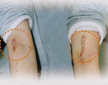 違法薬物について 警視庁