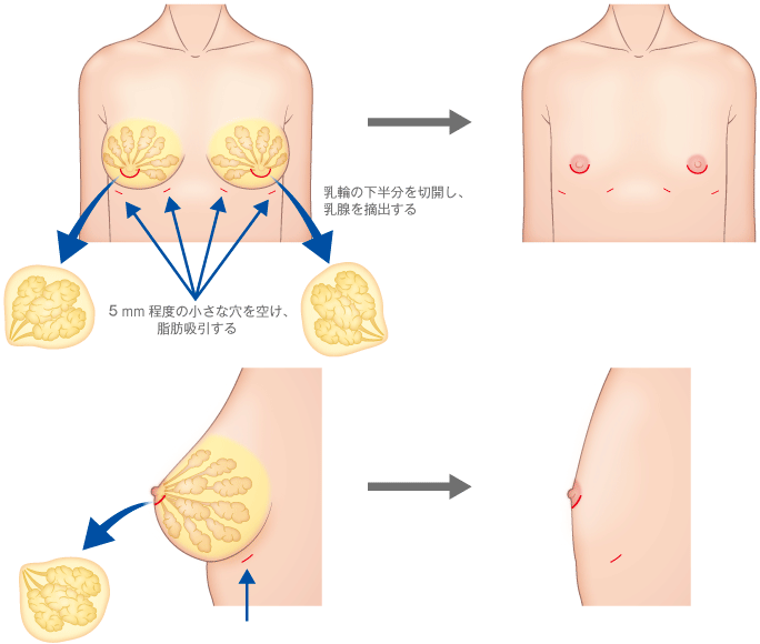 50%OFF】限界まで乳首イキしたい人の為の地獄級チクニーサポート [MayThird] | DLsite 同人