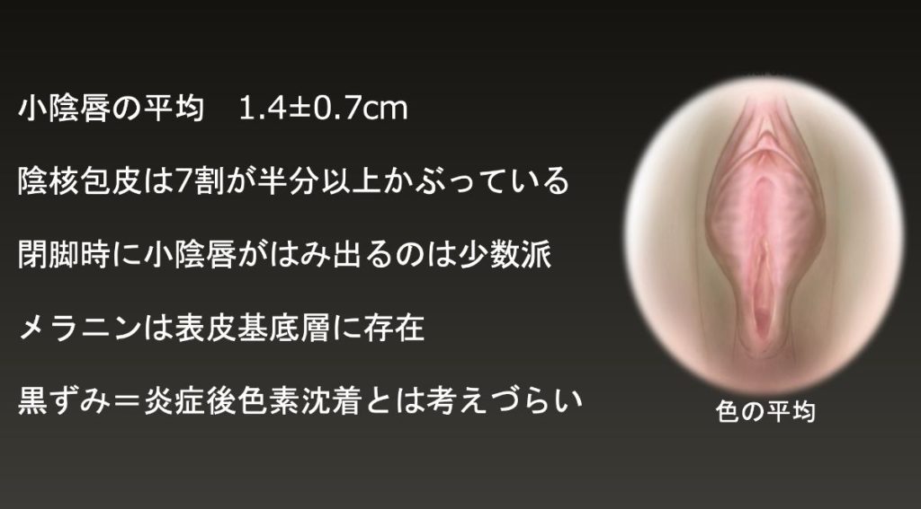 クリトリスが大きいことがコンプレックスです。目測では乳首ぐらいの大きさがあります。 | Peing -質問箱-