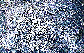 みんなの善意」で車いす寄贈 プルタブ集めた篠塚さんよみうりタウンニュース