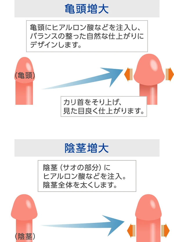 泌尿器専門医が解説】異物を入れずにカリ高ペニスを作る唯一の方法