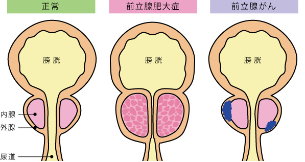 これから前立腺マッサージを始めたい方へ | アネロスジャパン