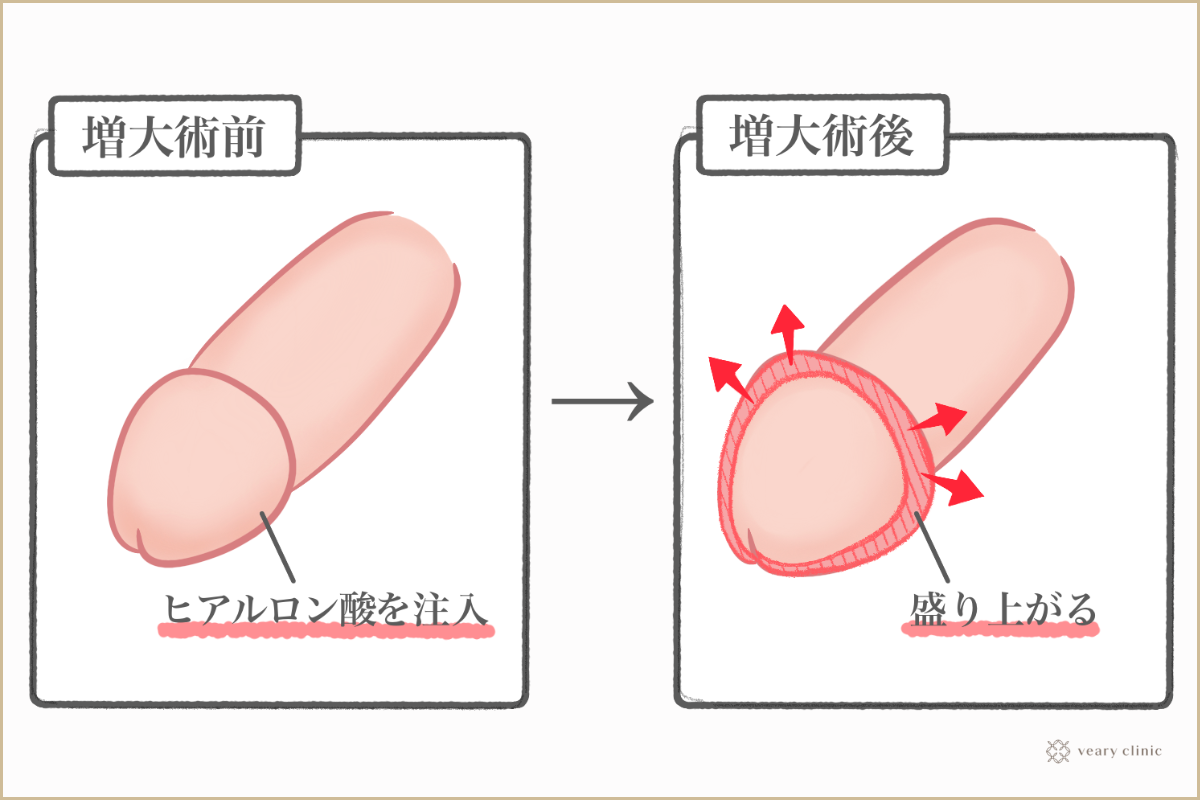 包茎手術について質問です | 神戸中央クリニック・男性診療