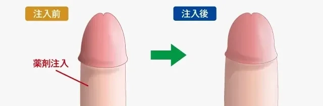 高校生以降ちんこはどう変化する？専門医に相談するべき人の特徴も解説 | 【フェアクリニック】包茎・薄毛・男の悩み相談所