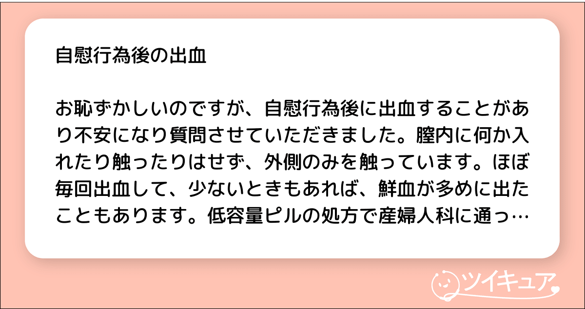 オナニーの後処理はティッシュがおすすめ！使い方や処理の仕方などを解説！｜風じゃマガジン