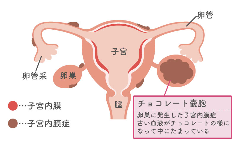 m3.com 電子書籍 | 癌取扱い規約抜粋 消化器癌・乳癌