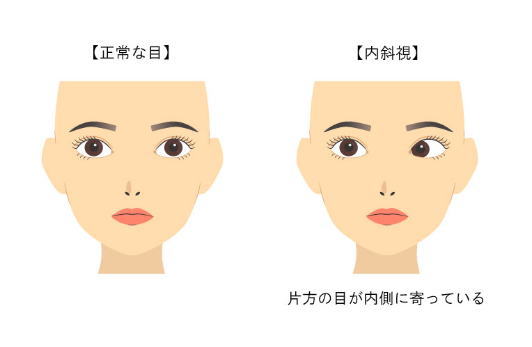 LINEでごみの分別を検索できます 鶴岡市
