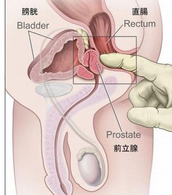 男の潮吹き」の真実 ～被験者が語る潮吹きのやり方～ - TENGAヘルスケア