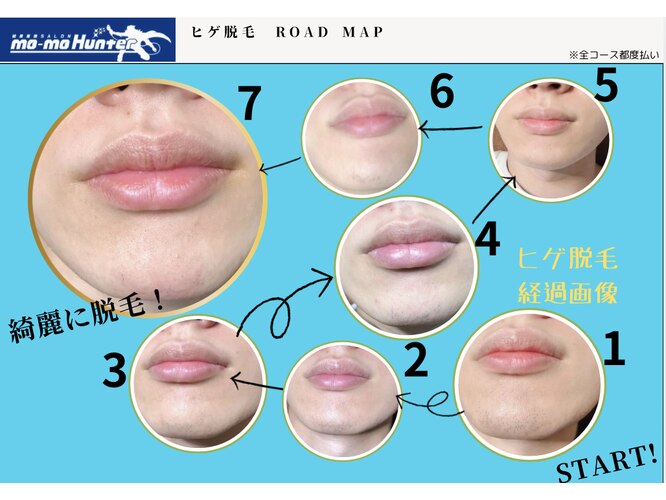 大阪(梅田•心斎橋)・東京の男性専用メンズ脱毛CHANGEでヒゲ脱毛