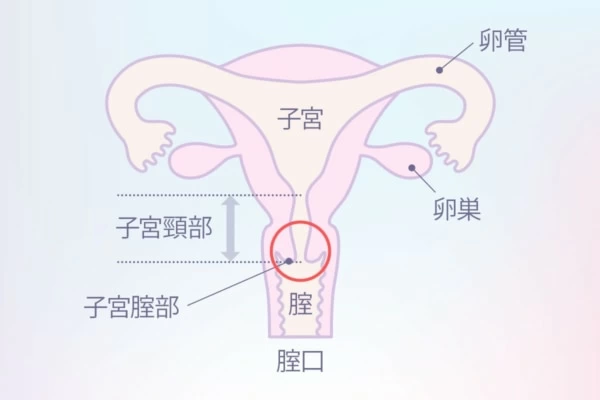 ポルチオとは？ 開発するとセックスが気持ちいい？ | 医師監修