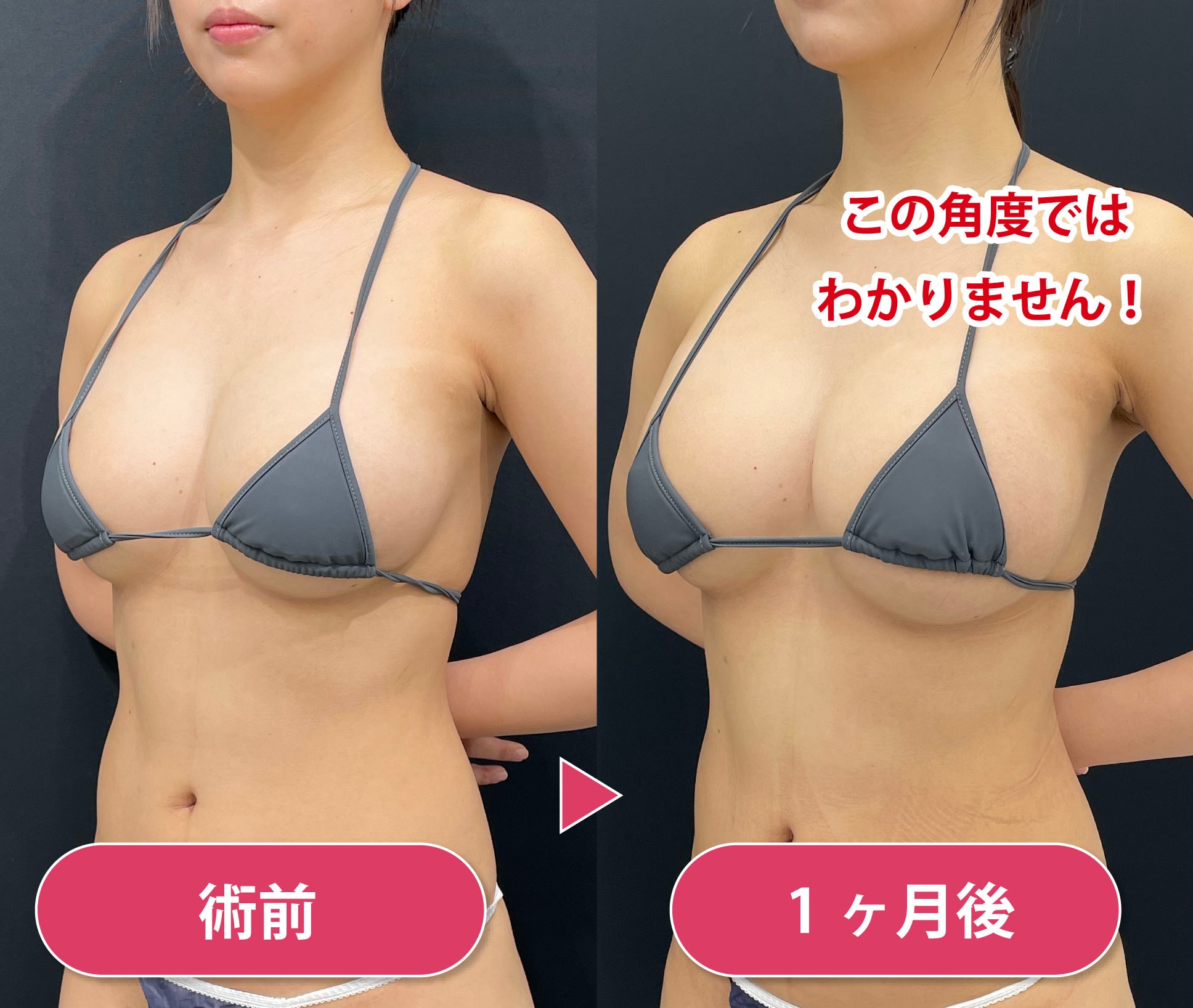 【下着紹介】透け感が可愛い！レースブラをレビュー