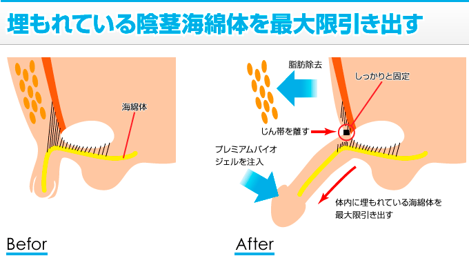 男性のペニスの平均サイズは何センチ？小さいデメリットや改善方法を解説 | ザヘルプM