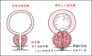 健康診断前日の食事や性行為・飲酒などの注意点について【運動やオススメの食べ物】 | ひまわり医院（内科・皮膚科）