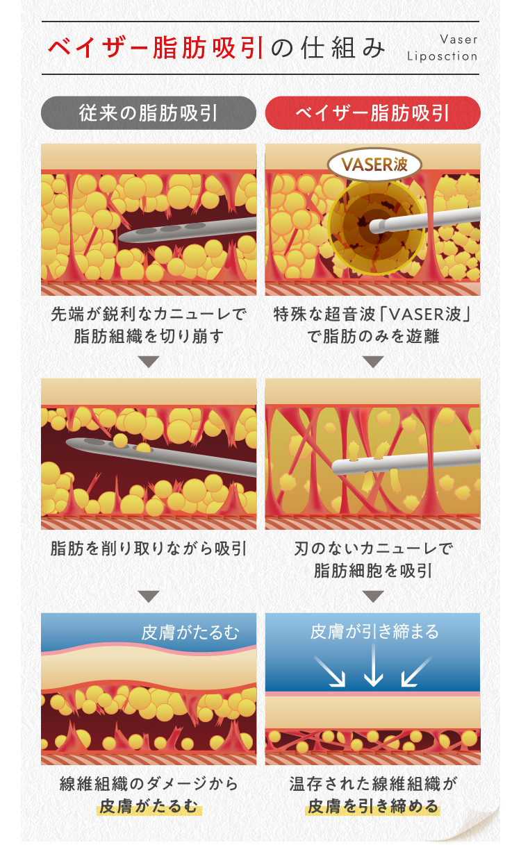 飲むだけで痩せる」は嘘！ダイエットサプリの10の真実とは？【メディケアダイエット論 #3】 | 【ダイエット外来体験者の肥満外来完全ガイド】