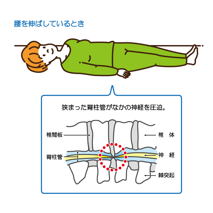 セックス後に股関節】が痛くなる原因と対策【負担をかけない体位】│しらひげ鍼灸整骨院