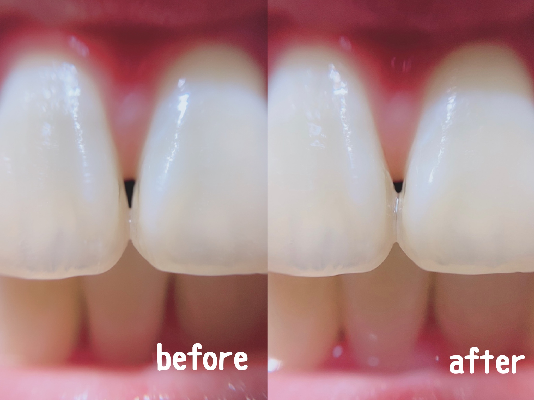 コナナノカの口コミ！私が3か月使った効果・使い方や解約方法Tips