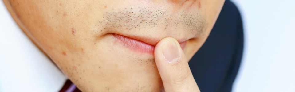 泥棒ヒゲフォトプロップス無料素材ダウンロード