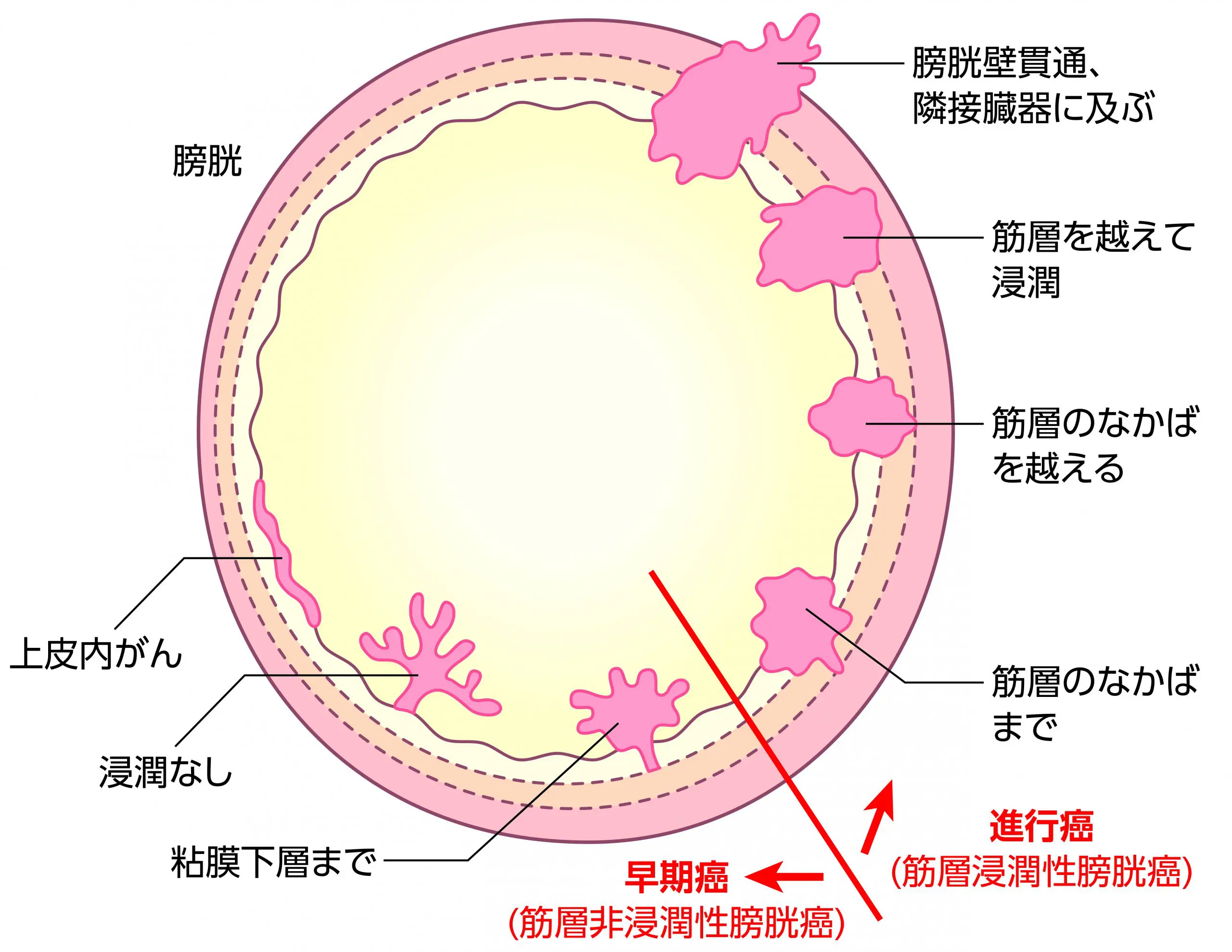 尿蛋白陽性と言われたら―蛋白尿の基準値や原因とは― | 市川駅前本田内科クリニック