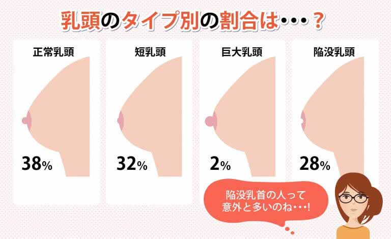 刺激されて出てくる瞬間がたまらない！？とびだせ陥没乳首！！ - アダルトDVD・ブルーレイ通販