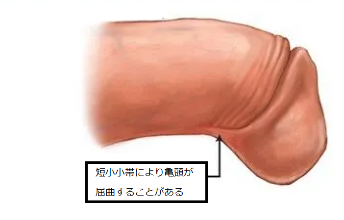 亀頭が敏感過ぎて悩んでます。どうやったら亀頭の感度を鈍らせることが出来ますか？ | Peing -質問箱-