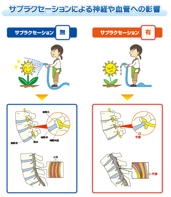 カイロプラティック　サブラクセーション 本