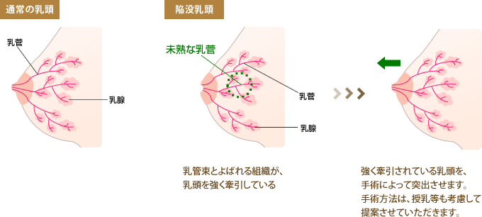 今から乳首を犯しにいってもいいですか？大阪店(イマカラチクビヲオカシニイッテモイイデスカオオサカテン)の風俗求人情報｜日本橋 オナクラ・ハンドサービス