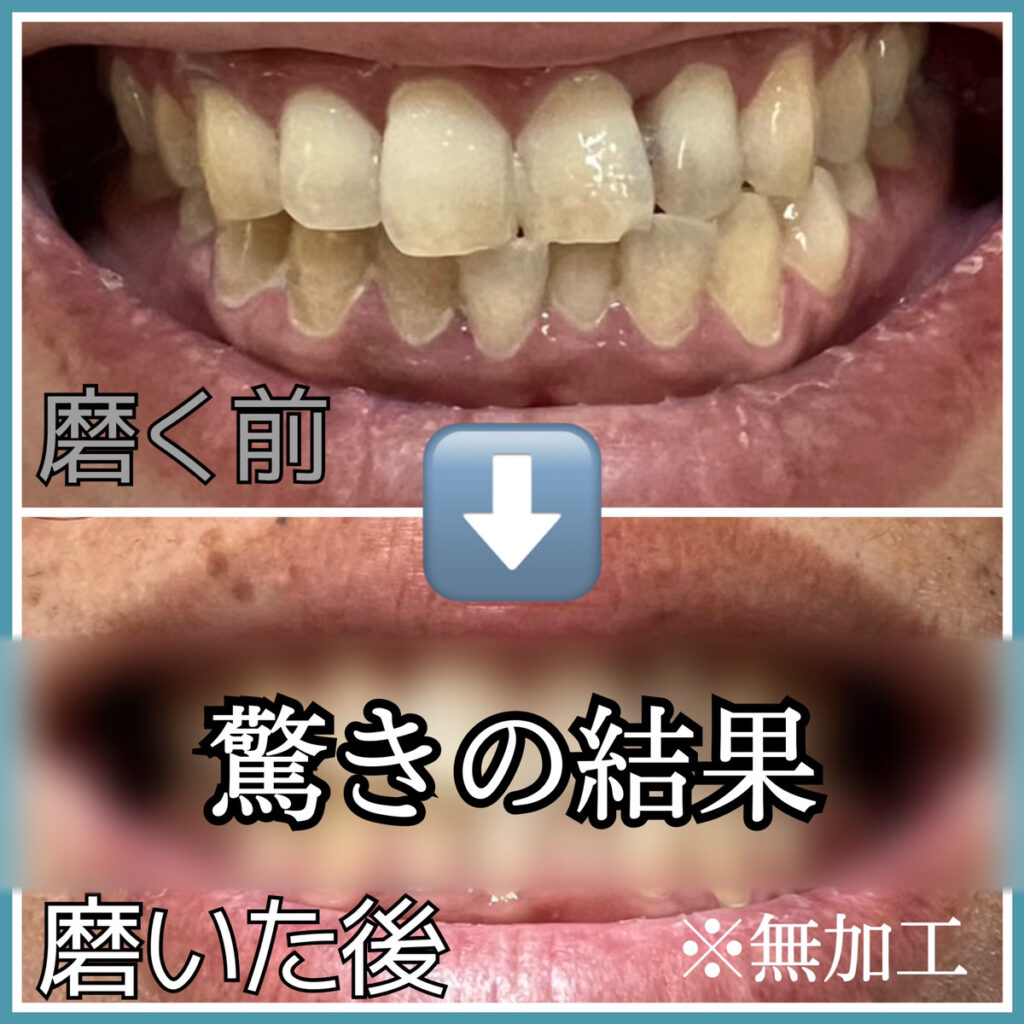 歯のホワイトニング 薬用コナナノカ 粉歯磨き オーラルケア