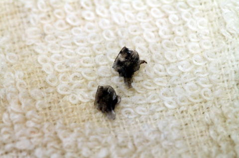 ガー：からだの特徴