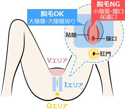 VIOってどんな形？みんなどこまで脱毛してるの？ | mismos（ミスモス）