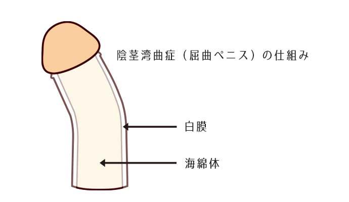 オナニーは左手を使うと世界が変わる！利き手じゃないと手コキされてる気分！ | happy-travel[ハッピートラベル]