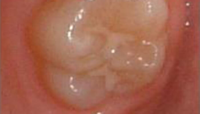 虫歯福富歯科クリニック相模原市矢部の歯医者