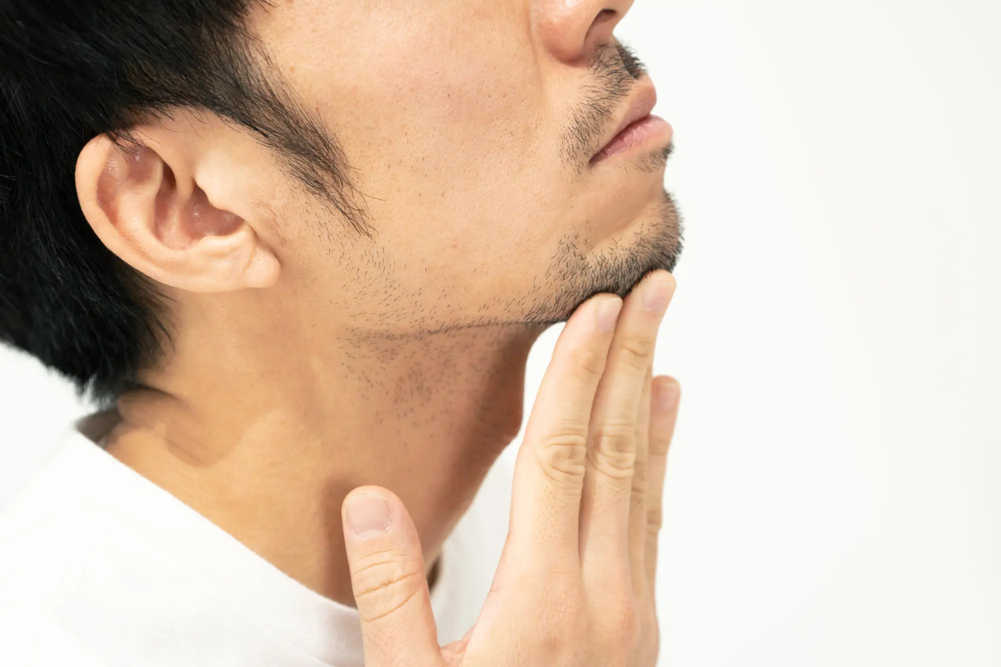 髭脱毛後にヒゲが濃くなった？ 硬毛化・増毛化・泥棒ヒゲの特徴と正しい対処法お役立ち情報東京・恵比寿のメンズ脱毛サロン アロンソ