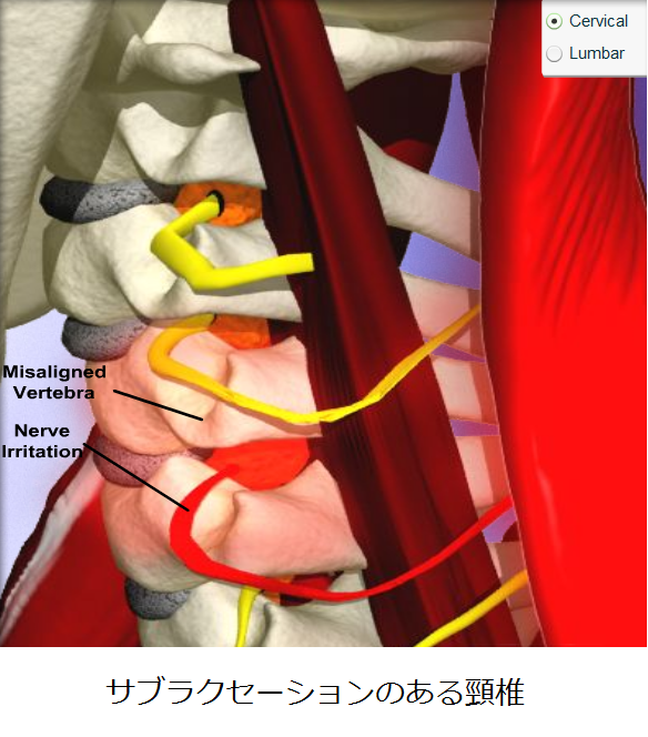 カイロプラクティックとは?