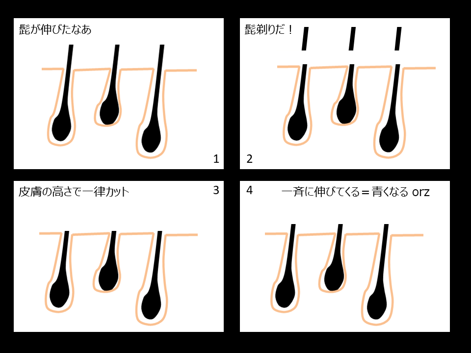 髭を抜くと起きる５つの危険！肌トラブルになったときの対処法も解説 | まるわかりメンズ脱毛