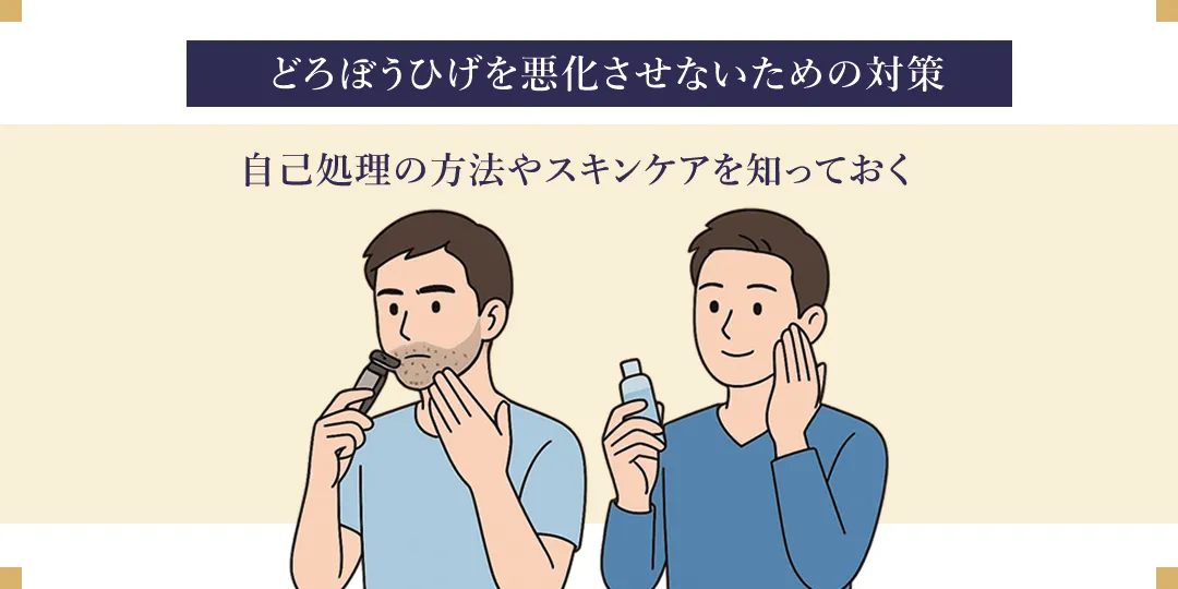 あきらめないで！ ヒゲ脱毛で「どろぼうひげ」になった時の神アフターケアと賢い乗り切り方まるわかりメンズ脱毛