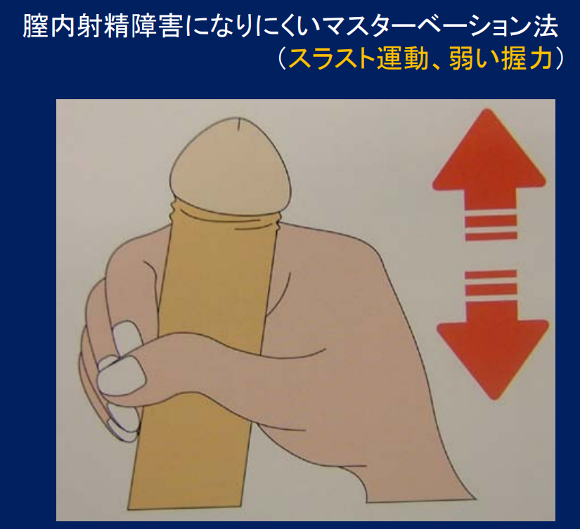 膣内射精障害・遅漏の新しい改善方法 | TENGAヘルスケア