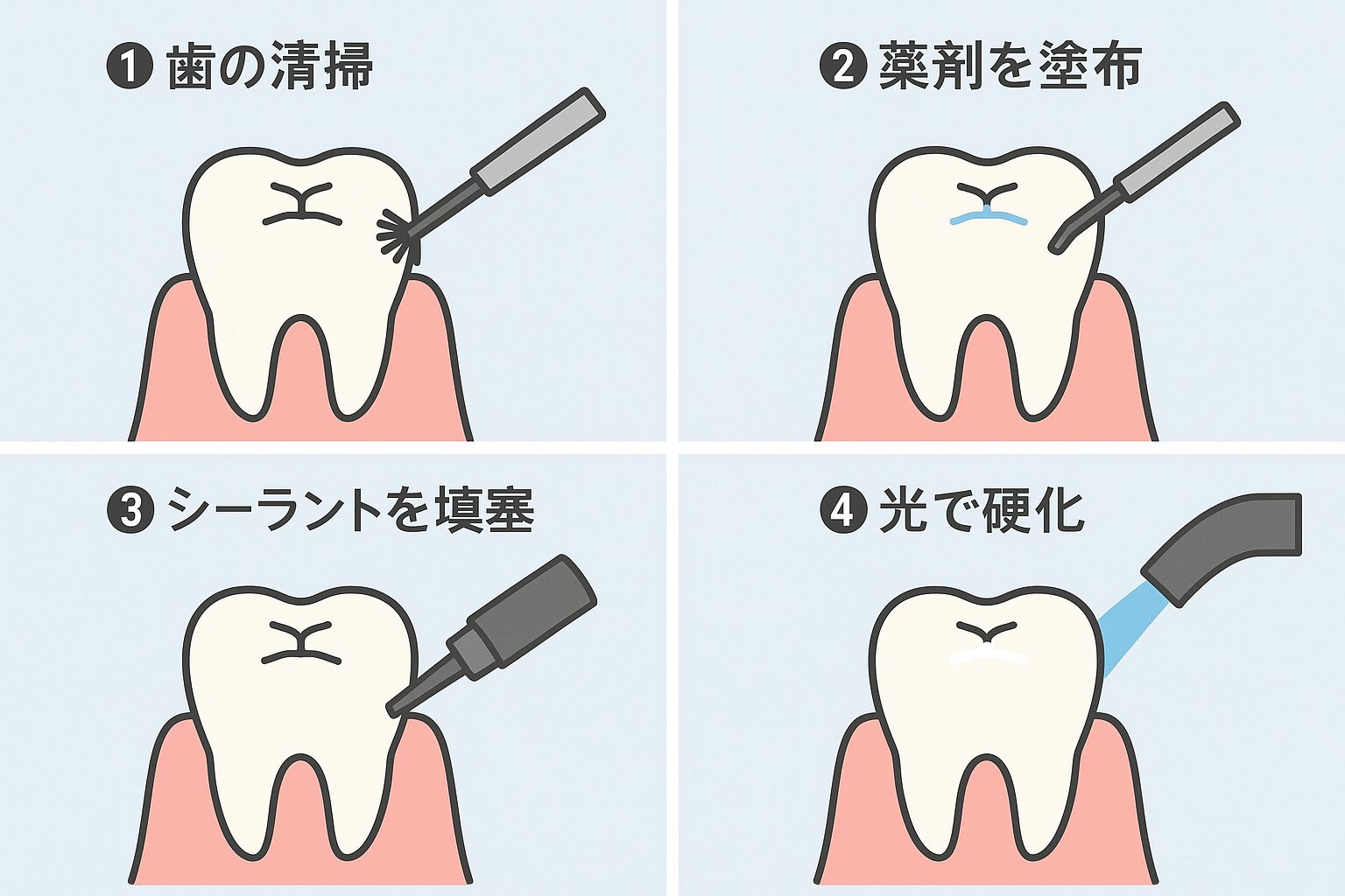 予防歯科 小窩裂溝とシーラント武蔵境 しらかば歯科
