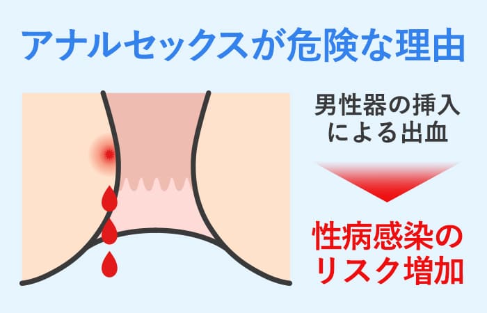 勃起は逆効果？】ちんこでケツイキさせる方法【アナルセックスの快感でイカす】 - エロいアナル大好き！アダルトアブノーマルな出会い