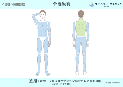 もみあげ脱毛 | 佐賀の男性専門脱毛サロン