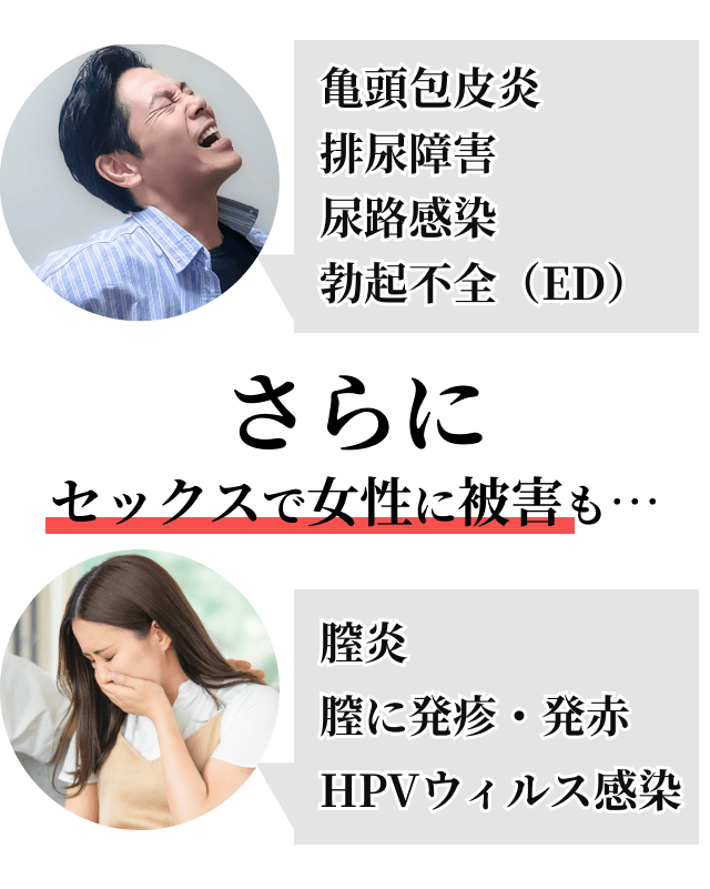 包茎がセックスに与える5つの影響！代表的な悩み＆注意点と治療法 - アトムクリニック