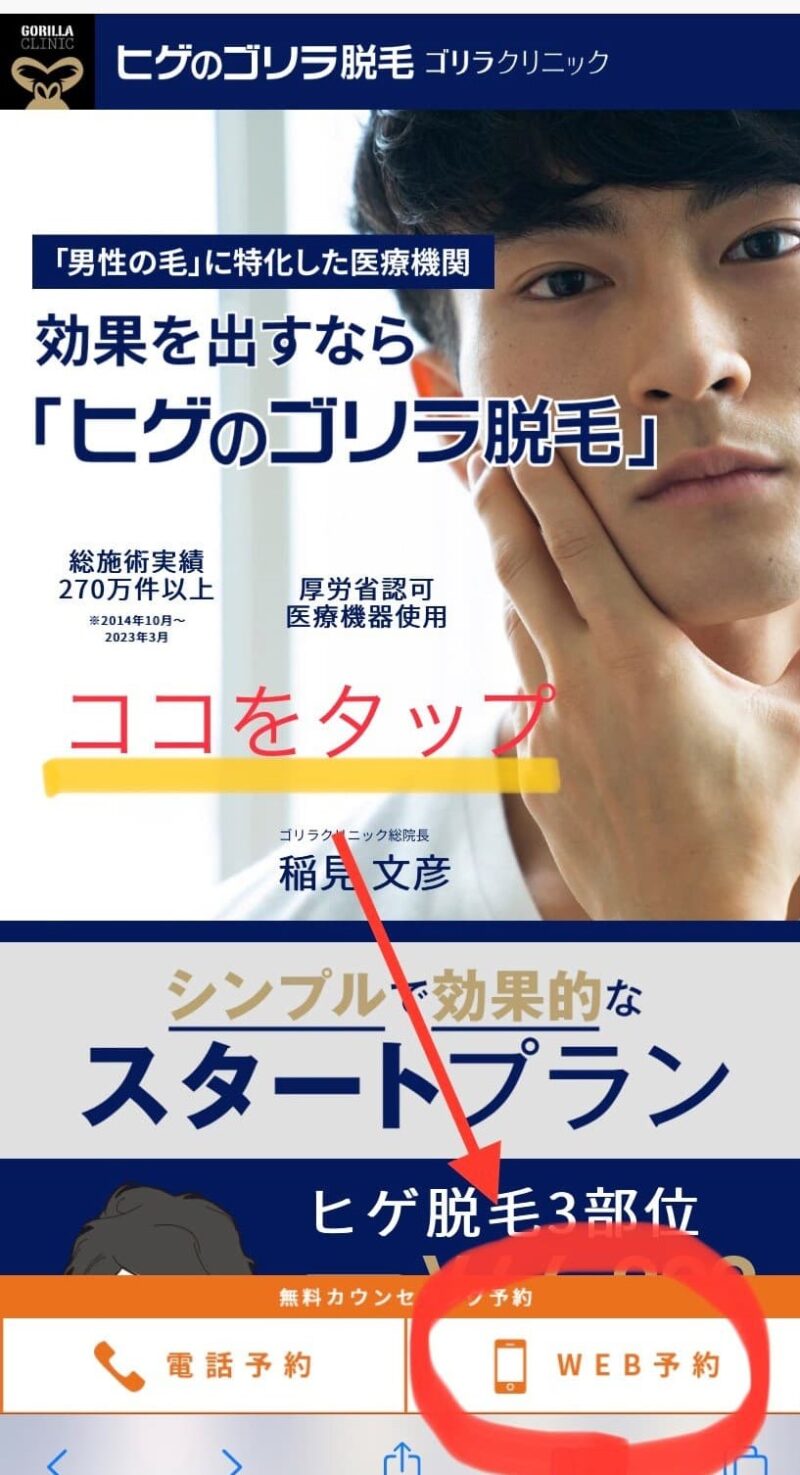 ゴリラクリニックの脱毛料金や口コミ評判を調査！学割・トライアルの詳細・おすすめポイントを紹介