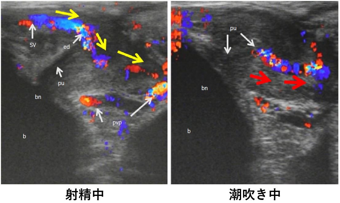 作品「女性用TENGAを使って初めての潮吹きオナニー」の画像20枚 - エロプル